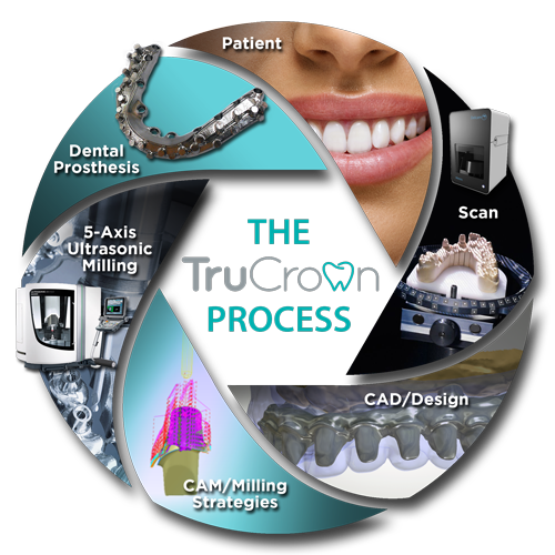The TruCrown Process Infographic 500px