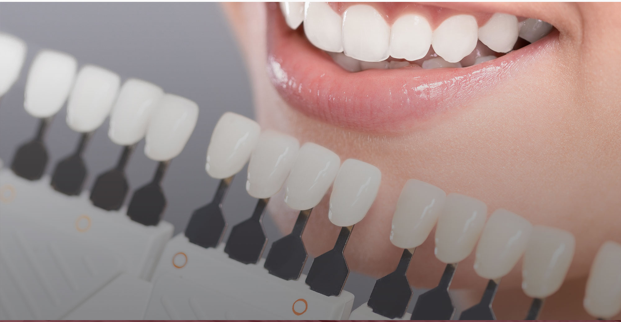 Implant-Slide-002