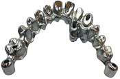 Implant Bridge