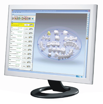 Dental Implant Design
