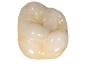 Full Contour IPS emax